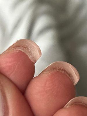 Glue under my nail .