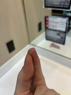 Sauna splinters from trying to stretch!