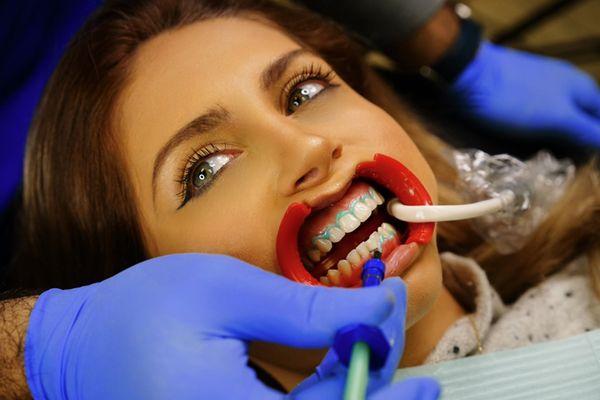 The Bright Spot - Teeth Whitening