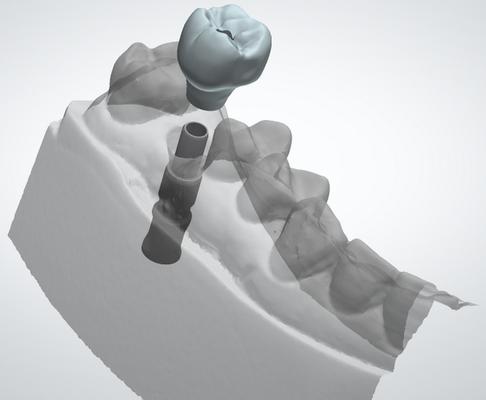 Dentek Dental Laboratory