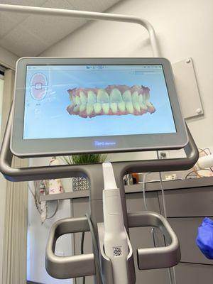 3D scan of teeth