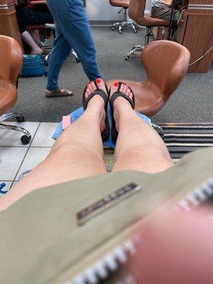 Treating my toes!