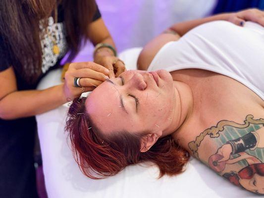 Moon Gate Acupuncture at Unity Wellness