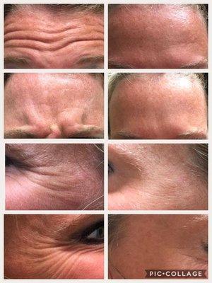 Elysian Med Spa