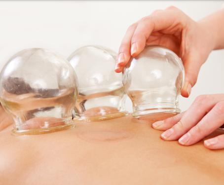 Cupping