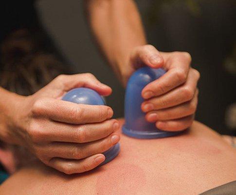 Cupping is used to expand compressed areas and facilitate circulation.