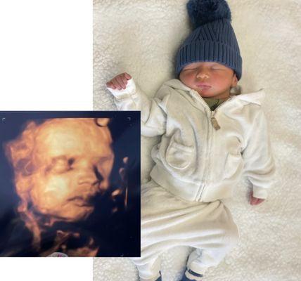 We did not get a great photo since his umbilical cord was in front of his face but got a quick glimpse at our baby.