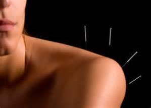 Dry Needling is offered,at the Norfolk Center Clinic of Physical Therapy and Sports Rehab, to treat pain.