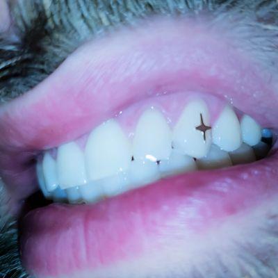 Gold tooth gem