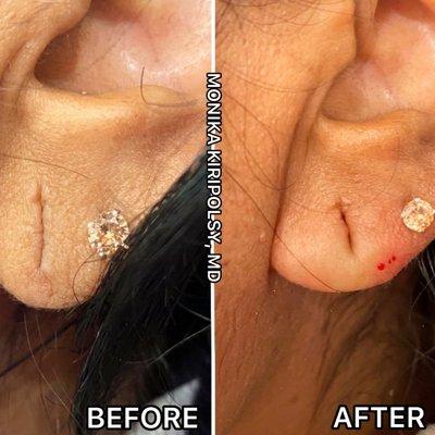 Monika Kiripolsky, MD FAAD FAACS