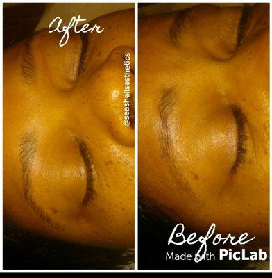 Sea Shells Esthetics