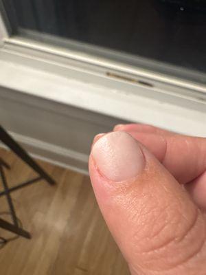 Top coat peeling off