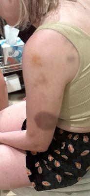 Peggy Gentrys son Christopher Gentry beat the shit out of my daughter and he has been harassing her non stop.