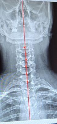 Natural Way Chiropractic of Bellingham