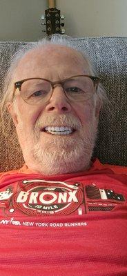 This was taken 1 day after surgery. I feel and look great.