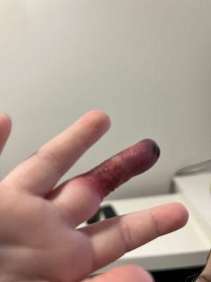 The Hand & Wrist Institute of Palm Beach