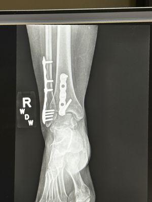 Medical City Denton Hospital Emergency Room