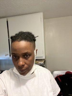 This is supposed to be A bald fade