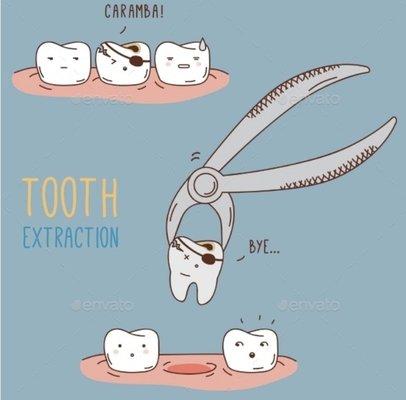 Sometimes a tooth has to be removed for many different reasons.. you have options to restore the tooth