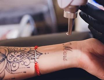 Miracle Skin Laser Spa