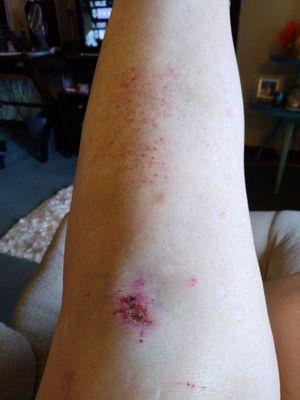 The Lodge At San Isabel