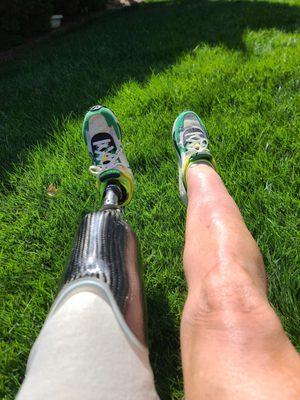 Great looking legs, I'd say! Just look at that prosthesis!