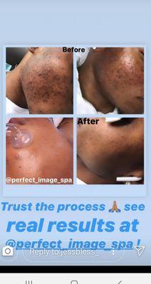 Perfect Image Spa