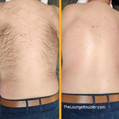 Back wax before and after.