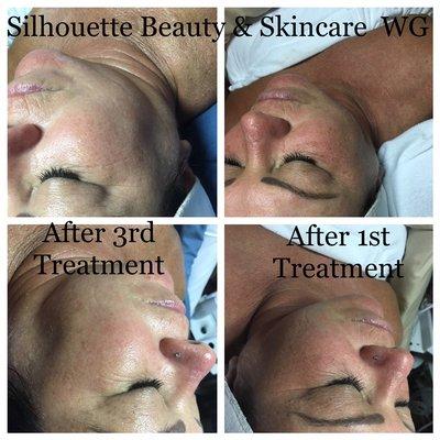 Silhouette Beauty & Skincare