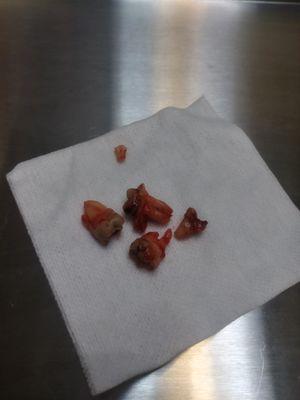 Spencer Dental & Braces