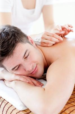 Jacksonville Acupuncture Wellness, PA