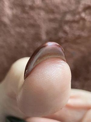 separation from fake and real nail