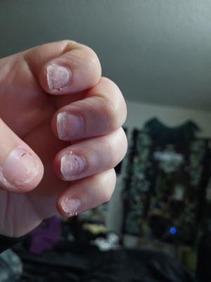 My nails now after 2 weeks
