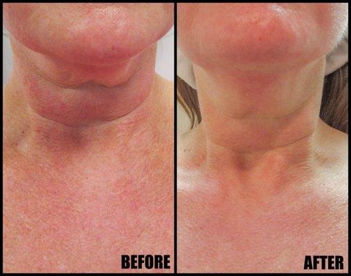 Fresh Faced Skin Care