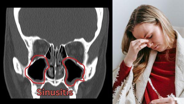 Sinus CT Scan Hollywood FL Relief for Pain, Congestion, Sinusitis