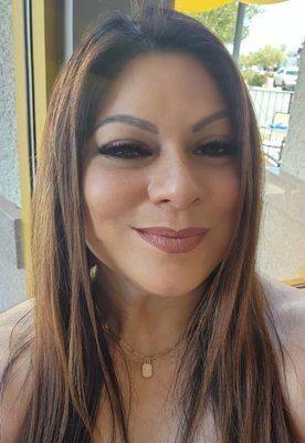 Forehead work. I have a scar that dents deeper as I get older. Diane does a good job smoothing it out.