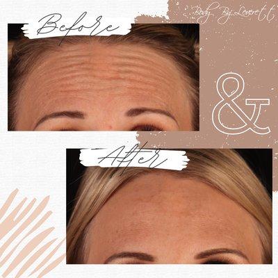 Larry C Leverett, MD FACS