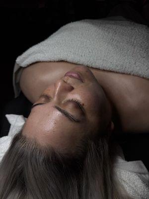 After Custom hydrating facial