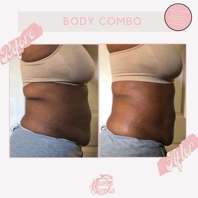 Before and after - Body combo