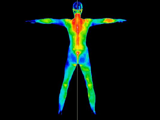 Radiation Free Thermography