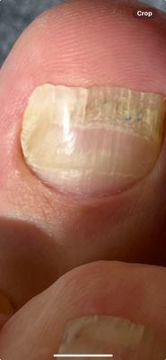 Elite Foot and Ankle Associates PLLC