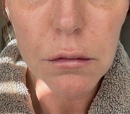 InnerBeauty Med Spa & Laser