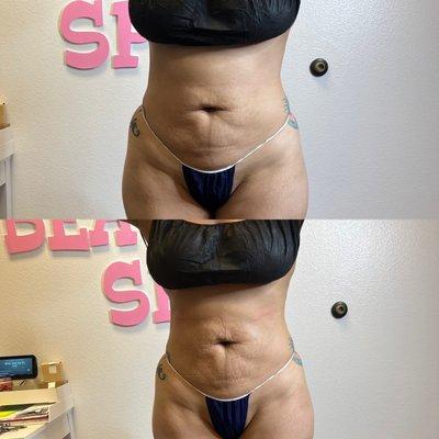 Glowgeous Skin Beauty & Aesthetics