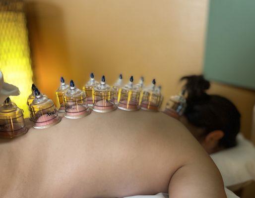 Cupping helps improve blood flow and reduce pain.