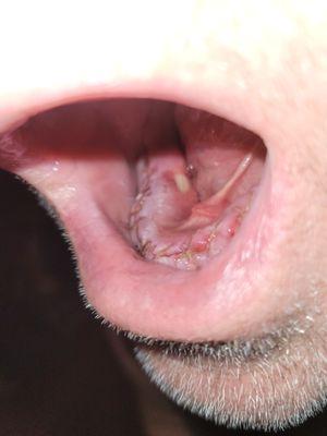 Oral & Facial Surgery - Lewiston