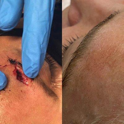 Injury before and after.