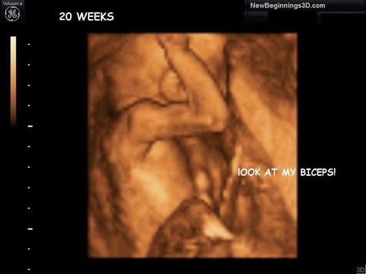New Beginnings 3D Ultrasound