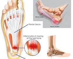 PLT Massage and Wellness