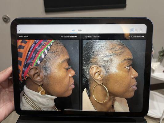 Hand & Stone Massage and Facial Spa