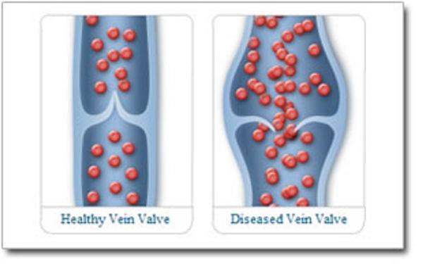 Tri-State Vein Center